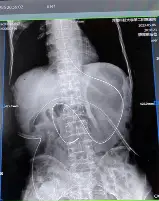 独家:德约科维奇状态火爆(德约科维奇39岁延续巅峰之路) 独家:德约科维奇状态火爆(德约科维奇39岁延续巅峰之路)